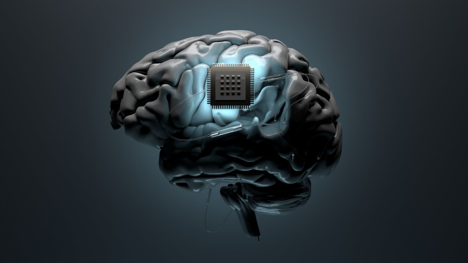 Implantación de chips cerebrales para pacientes con parálisis creados por Neuralink